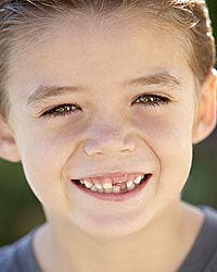 photo of a young boy who's starting to lose his baby teeth