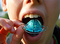 photo of a boy inserting a blue retainer into his mouth